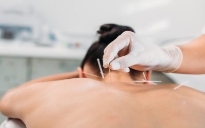 Natural Stress Relief Solutions from a Local Acupuncturist In Union City, CA