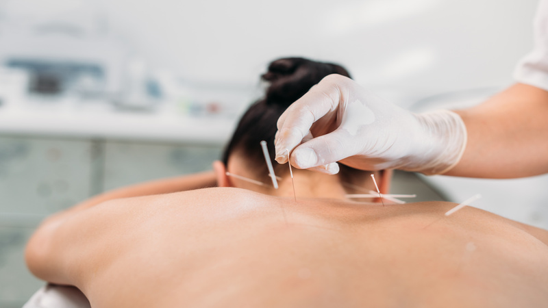 Natural Stress Relief Solutions from a Local Acupuncturist In Union City, CA