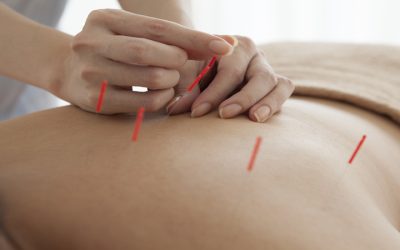 Addressing Infertility Challenges With Acupuncture For Fertility In Berkeley, CA Methods