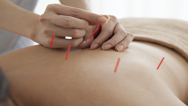 Addressing Infertility Challenges With Acupuncture For Fertility In Berkeley, CA Methods