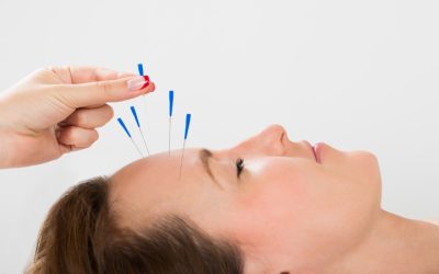 Reducing Stress and Anxiety Effectively Using Acupuncture Oakland, CA Services