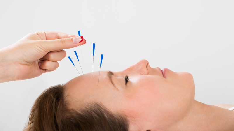 Reducing Stress and Anxiety Effectively Using Acupuncture Oakland, CA Services